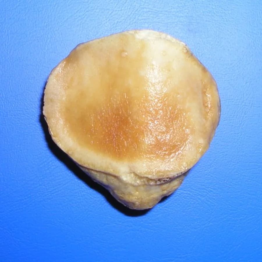 Kneecap